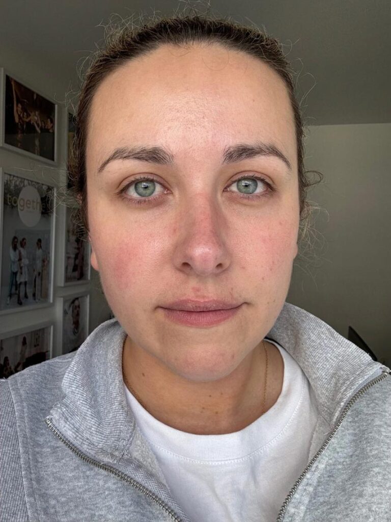 Full face shot — correct example