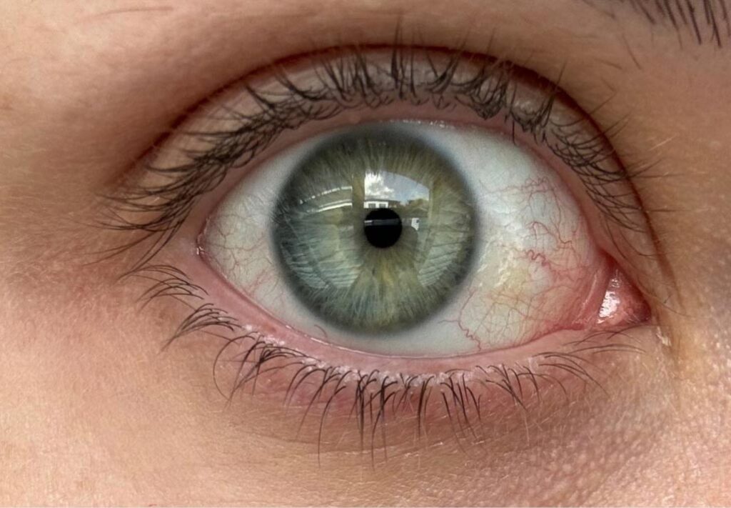 Eye close-up — correct example